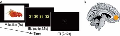 Extrinsic Factors Underlying Food Valuation in the Human Brain